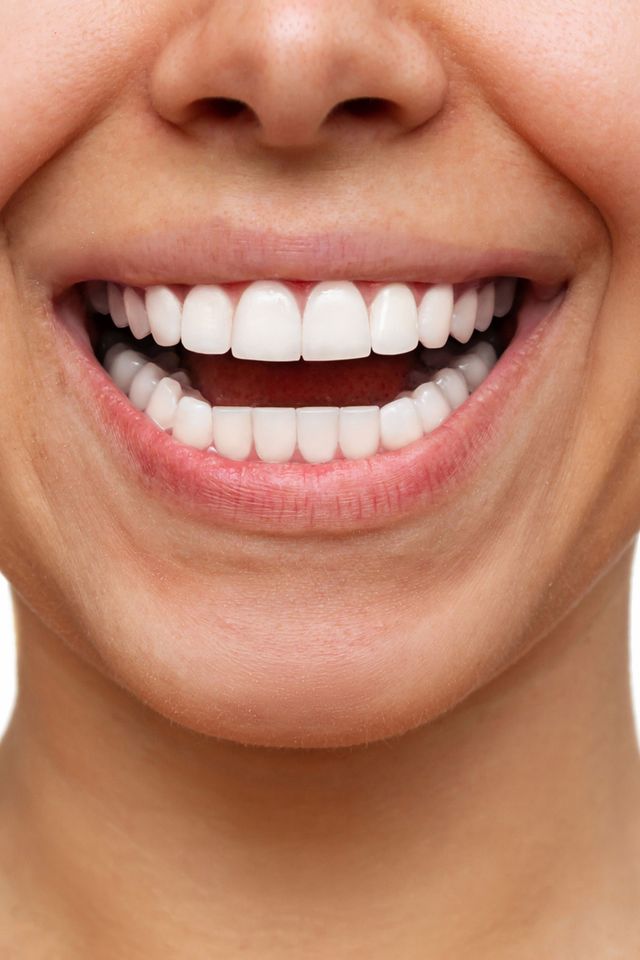 Smile Gallery - A2Z Dental - Before and After Photos